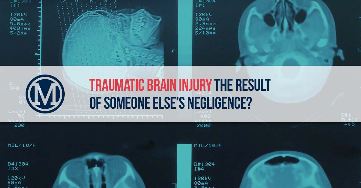 Traumatic Brain Injury Lawyers - McDonald Law Firm